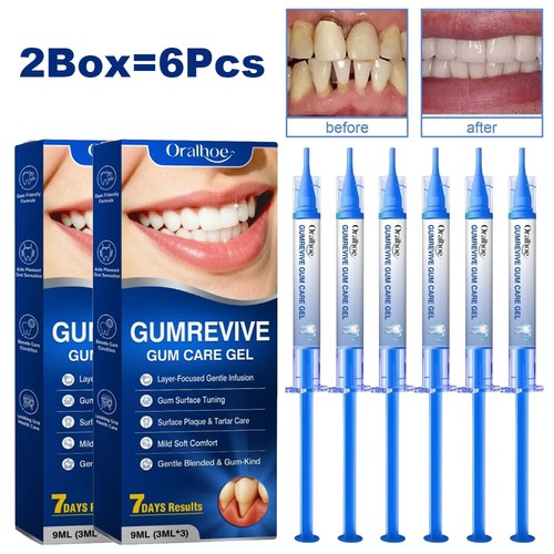 6pcs 2box gum repair gel - gum,