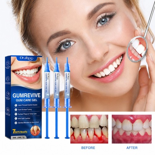 3pcs box gum - gum, repair