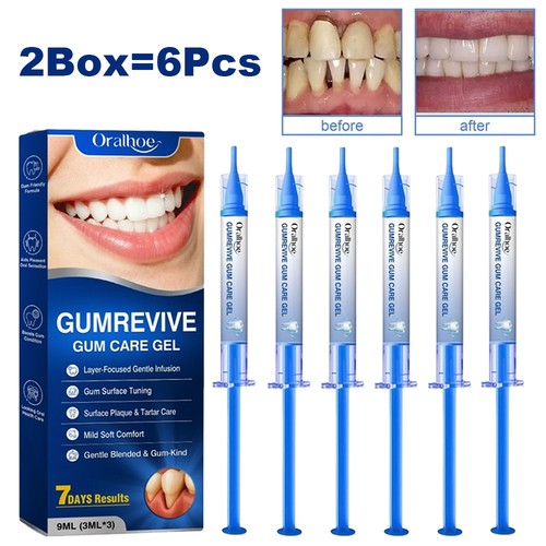6pcs 2box gum repair gel - 6pcs/2box,