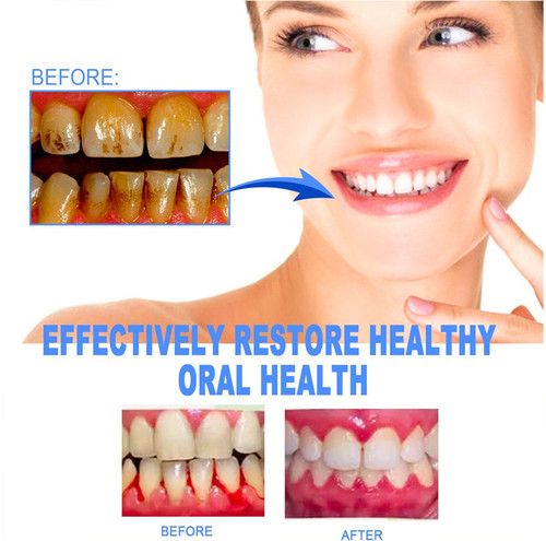 Gum therapy gel mullein - therapy,