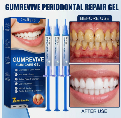 Gumrevive periodontal repair - periodontal,