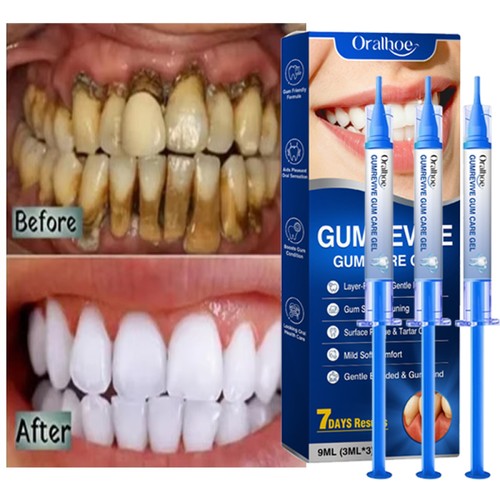 Gum revive periodontal repair - periodontal,