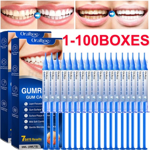 300pcs gum repair gel teeth - 3-300pcs,