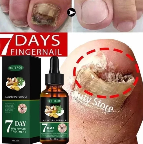 Fungal nail treatment strong - nail,