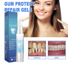 Elycura Gum Repair Gel,Elycura